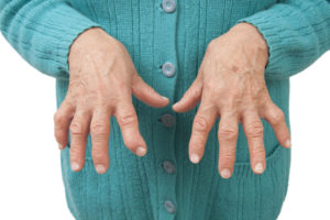 Rheumatoid Arthritis clinical trials